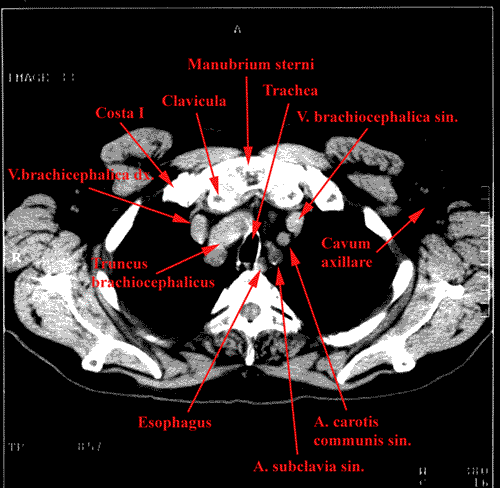 anatomia radiologiczna - 21.gif